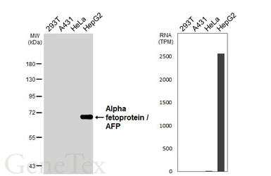 Anti-Alpha fetoprotein / AFP antibody [HL6119] used in Western Blot (WB). GTX648204