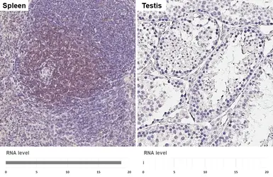 Anti-CD3 epsilon antibody [HL6121] used in IHC (Paraffin sections) (IHC-P). GTX648206