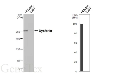 Anti-Dysferlin antibody [HL6123] used in Western Blot (WB). GTX648208