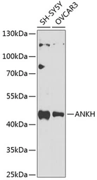 Anti-ANKH antibody used in Western Blot (WB). GTX64821