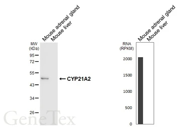 Anti-CYP21A2 antibody [HL6128] used in Western Blot (WB). GTX648213