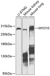 Anti-MYO10 antibody used in Western Blot (WB). GTX64824
