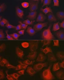 Anti-MYO10 antibody used in Immunocytochemistry/ Immunofluorescence (ICC/IF). GTX64824