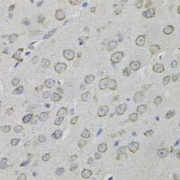 Anti-MYO10 antibody used in IHC (Paraffin sections) (IHC-P). GTX64824