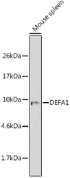 Anti-Defensin alpha 1 antibody used in Western Blot (WB). GTX64827