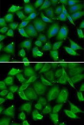 Anti-Defensin alpha 1 antibody used in Immunocytochemistry/ Immunofluorescence (ICC/IF). GTX64827