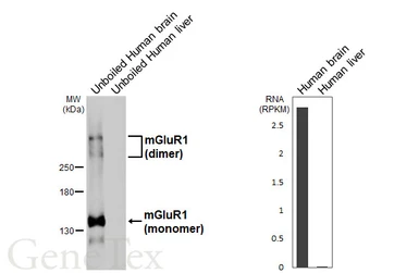 Anti-mGluR1 antibody [HL6190] used in Western Blot (WB). GTX648282