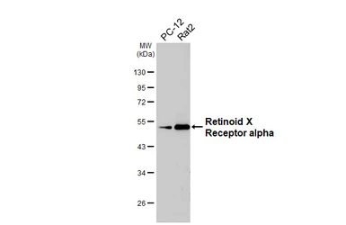 Anti-Retinoid X Receptor alpha antibody [HL6191] used in Western Blot (WB). GTX648283
