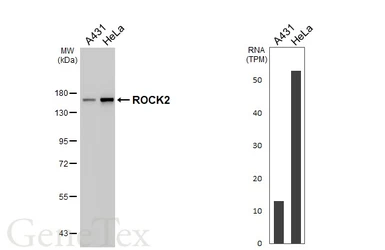 Anti-ROCK2 antibody [HL6209] used in Western Blot (WB). GTX648301