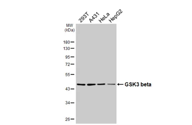 Anti-GSK3 beta antibody [HL6229] used in Western Blot (WB). GTX648321