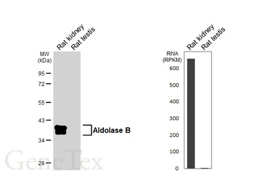 Anti-Aldolase B antibody [HL6236] used in Western Blot (WB). GTX648328