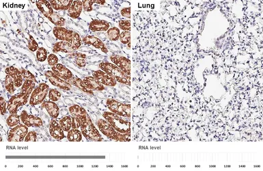 Anti-Aldolase B antibody [HL6236] used in IHC (Paraffin sections) (IHC-P). GTX648328