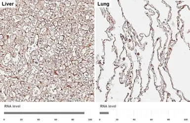 Anti-CD13 antibody [HL6252] used in IHC (Paraffin sections) (IHC-P). GTX648344