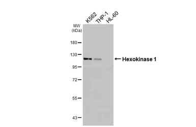 Anti-Hexokinase 1 antibody [HL6256] used in Western Blot (WB). GTX648348