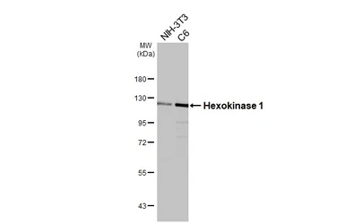 Anti-Hexokinase 1 antibody [HL6256] used in Western Blot (WB). GTX648348