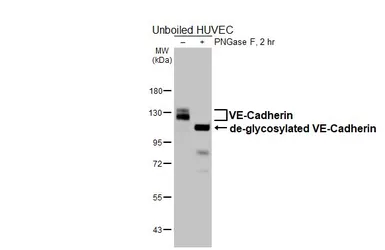 Anti-VE-Cadherin antibody [HL6263] used in Western Blot (WB). GTX648355