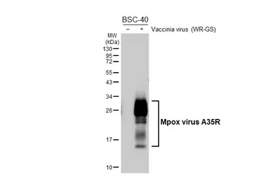 Anti-Mpox virus A35R antibody [HL6293] used in Western Blot (WB). GTX648395