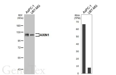 Anti-AXIN1 antibody [HL6296] used in Western Blot (WB). GTX648398