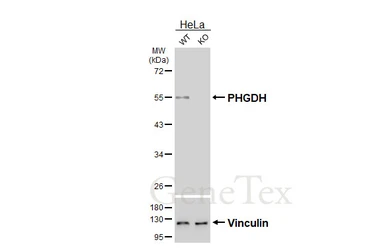 Anti-PHGDH antibody [HL6297] used in Western Blot (WB). GTX648399