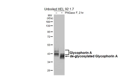 Anti-Glycophorin A antibody [HL6300] used in Western Blot (WB). GTX648402