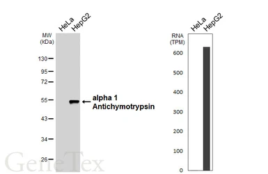 Anti-alpha 1 Antichymotrypsin antibody [HL6303] used in Western Blot (WB). GTX648405