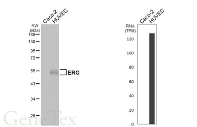 Anti-ERG antibody [HL6309] used in Western Blot (WB). GTX648411