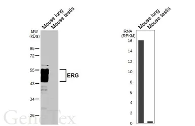 Anti-ERG antibody [HL6309] used in Western Blot (WB). GTX648411