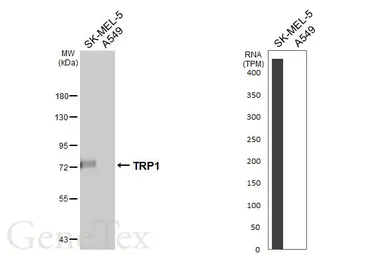 Anti-TRP1 antibody [HL6342] used in Western Blot (WB). GTX648452
