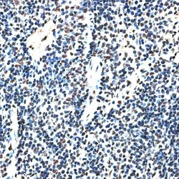 Anti-RBM17 antibody used in IHC (Paraffin sections) (IHC-P). GTX64861
