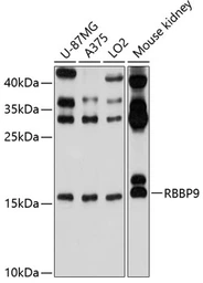 Anti-RBBP9 antibody used in Western Blot (WB). GTX64865