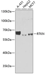 Anti-Rhotekin antibody used in Western Blot (WB). GTX64868