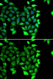 Anti-IKZF3 antibody used in Immunocytochemistry/ Immunofluorescence (ICC/IF). GTX64869