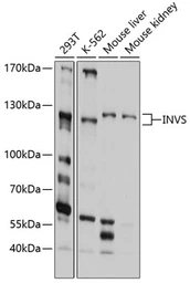 Anti-Inversin antibody used in Western Blot (WB). GTX64870