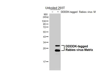Anti-Rabies virus Matrix antibody [HL6365] used in Western Blot (WB). GTX648804