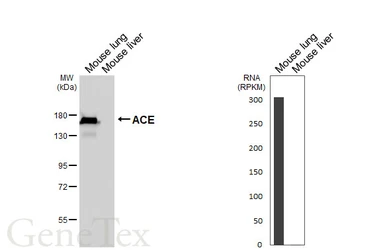 Anti-ACE antibody [HL6377] used in Western Blot (WB). GTX648816