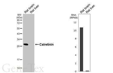 Anti-Calretinin antibody [HL6379] used in Western Blot (WB). GTX648818