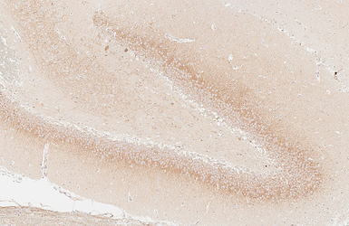 Anti-Calretinin antibody [HL6380] used in IHC (Paraffin sections) (IHC-P). GTX648819