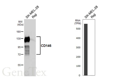 Anti-CD146 antibody [HL6385] used in Western Blot (WB). GTX648824