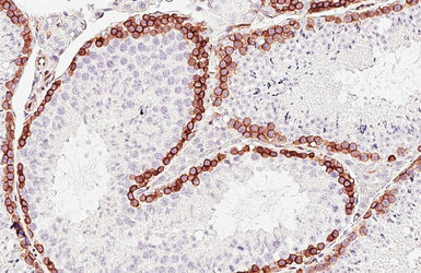 Anti-CD146 antibody [HL6385] used in IHC (Paraffin sections) (IHC-P). GTX648824