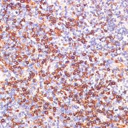 Anti-GPSM2 antibody used in IHC (Paraffin sections) (IHC-P). GTX64884