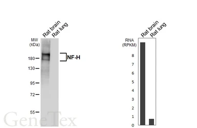 Anti-NF-H antibody [HL6395] used in Western Blot (WB). GTX648840