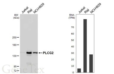 Anti-PLCG2 antibody [HL6425] used in Western Blot (WB). GTX648870