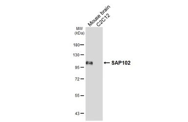 Anti-SAP102 antibody [HL6440] used in Western Blot (WB). GTX648888