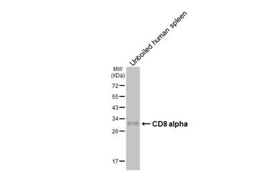 Anti-CD8 alpha antibody [HL6447] used in Western Blot (WB). GTX648895