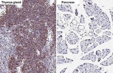 Anti-Ki67 antibody [HL6451] used in IHC (Paraffin sections) (IHC-P). GTX648899