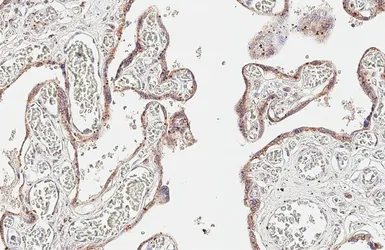 Anti-MAN2A1 antibody [HL6456] used in IHC (Paraffin sections) (IHC-P). GTX648904