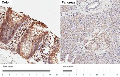 Anti-MAN2A1 antibody [HL6456] used in IHC (Paraffin sections) (IHC-P). GTX648904