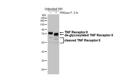Anti-TNF Receptor II antibody [HL6463] used in Western Blot (WB). GTX648911