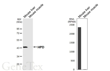 Anti-HPD antibody [HL6468] used in Western Blot (WB). GTX648916