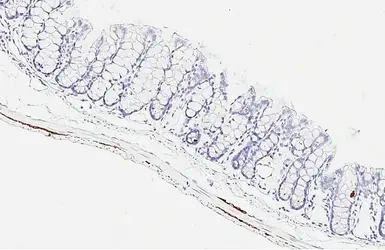 Anti-Peripherin antibody [HL6471] used in IHC (Paraffin sections) (IHC-P). GTX648919